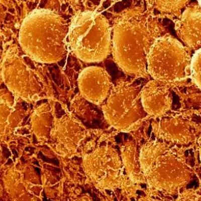 哥伦比亚大学强力教授/梁锦荣院士《Nature Nanotechnology》：想瘦哪里瘦哪里！聚阳离子纳米药物靶向治疗肥胖症